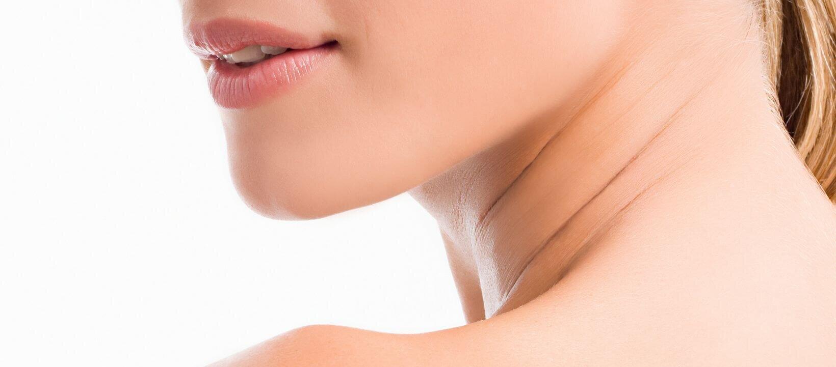 Woman after chin filler at Medisha clinic